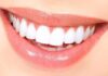 Natural Teeth Whitening Hacks You Can DIY at Home