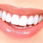 Natural Teeth Whitening Hacks You Can DIY at Home