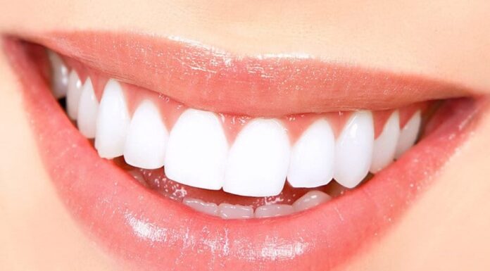 Natural Teeth Whitening Hacks You Can DIY at Home