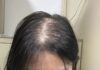 Unlock Rapid Hair Growth: Discover the Korean Secret to Doubling Hair Length in Just One Month!