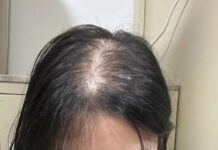 Unlock Rapid Hair Growth: Discover the Korean Secret to Doubling Hair Length in Just One Month!