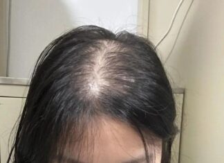 Unlock Rapid Hair Growth: Discover the Korean Secret to Doubling Hair Length in Just One Month!