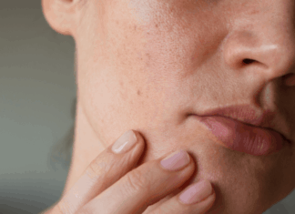 Combat Wrinkles This Dry Season: Expert Tips for Flawless Skin