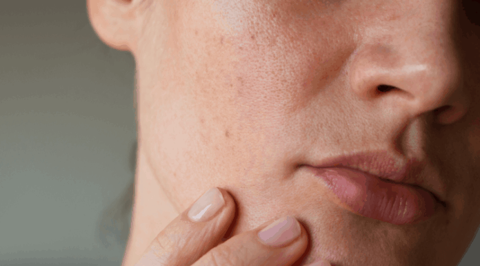 Combat Wrinkles This Dry Season: Expert Tips for Flawless Skin