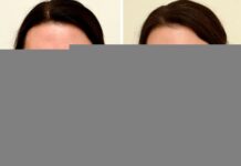 “Transform Your Skin in Just 1 Month: The Affordable Daily Drink That Gave a 45-Year-Old Woman a Stunning, Youthful Glow”