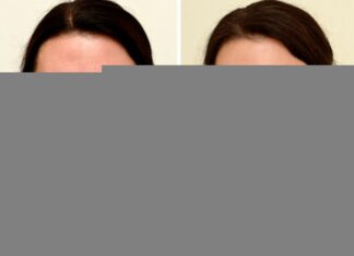 “Transform Your Skin in Just 1 Month: The Affordable Daily Drink That Gave a 45-Year-Old Woman a Stunning, Youthful Glow”