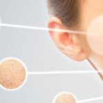 Dry Skin Remedies: Causes and 11 Effective Home Treatments