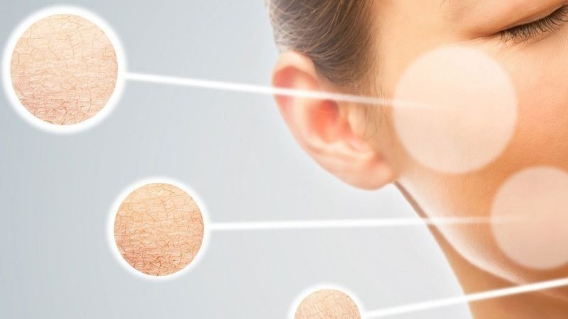 Dry Skin Remedies: Causes and 11 Effective Home Treatments