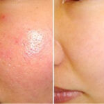 Benefits of Washing Your Face with Warm Water: When is the Best Time to Do It?