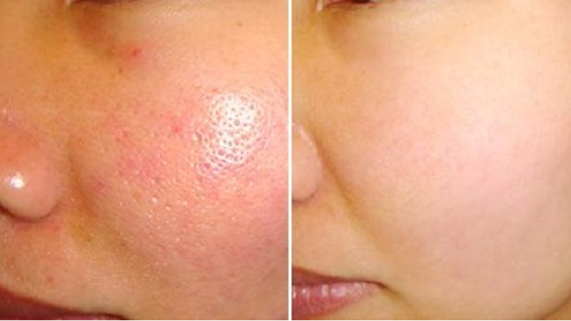 Benefits of Washing Your Face with Warm Water: When is the Best Time to Do It?