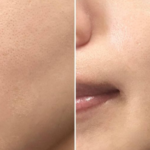 “Multi-Step Skincare Routine Not Working? Discover How Korean Women ‘Reset’ Their Skin for a Smooth, Poreless Complexion”