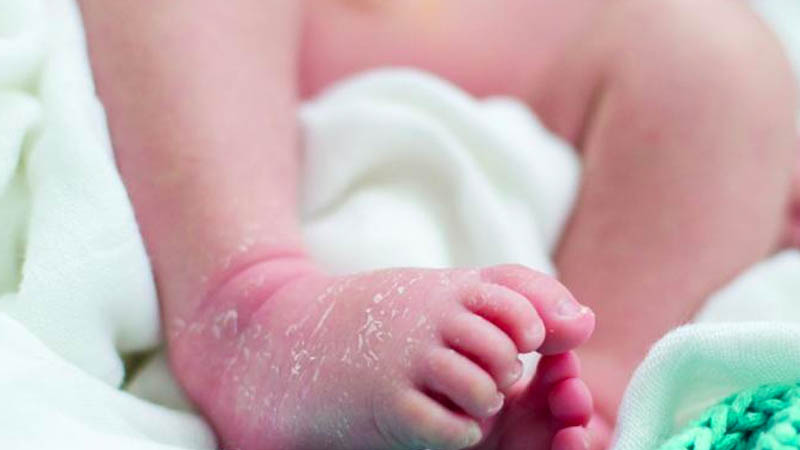 What Causes Peeling Skin on Hands and Feet in Children?